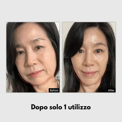 Before and after images of a woman's face, highlighted with dotted red lines along the jaw.